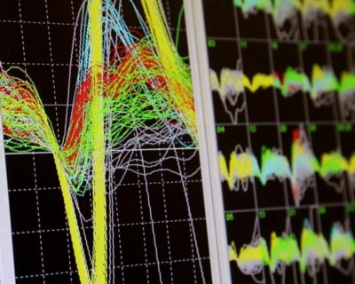 Monkeys' Brains Synchronize As They Collaborate To Perform A Motor Task
